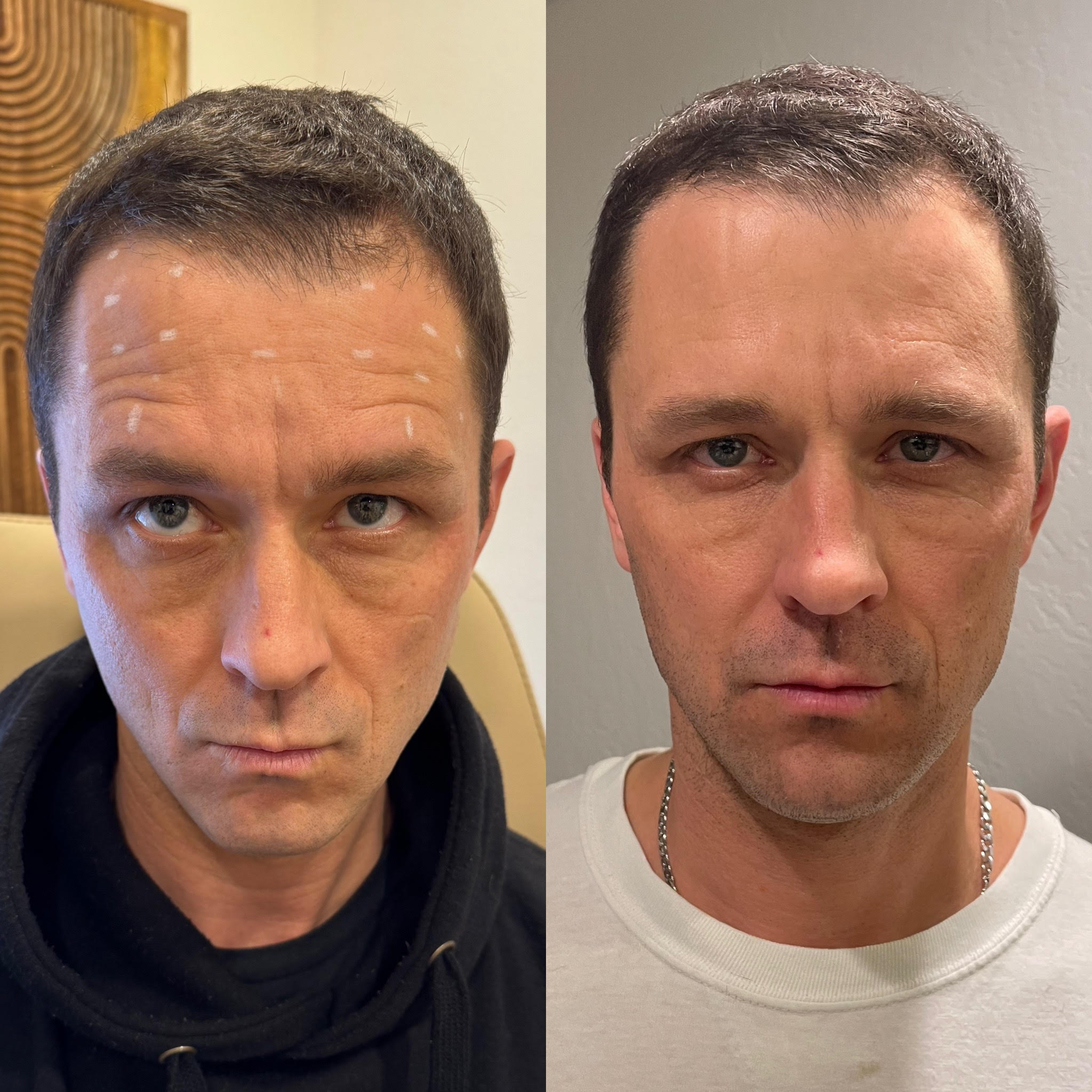 Precision Tox - Before & After